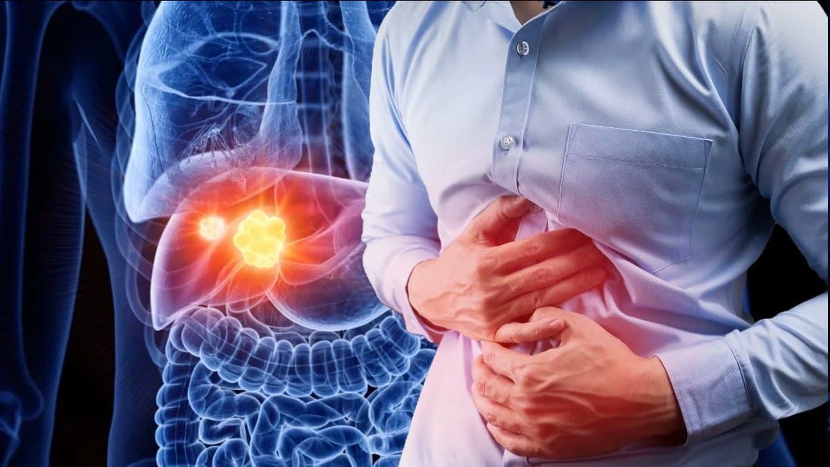 Мутахассис: Ошқозон ости бези яллиғланишини ўз вақтида даволамаслик "сахар"га сабаб бўлиши мумкин