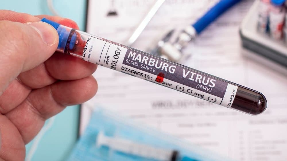 ЖССТ: Марбург вируси дунёда янги пандемияга сабаб бўлиши мумкин