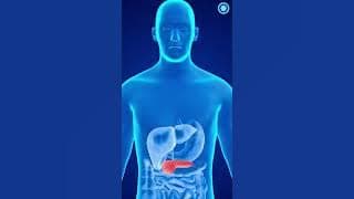 Pankreatit — oshqozon osti bezining o'tkir yallig'lanishi bilan kechadigan kasallik