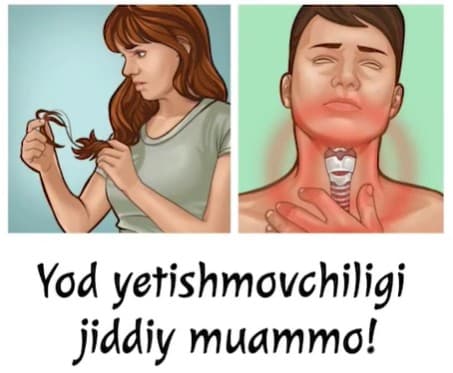 JSST tahliliga ko'ra, dunyo aholisining uchdan bir qismi tabiiy yod tanqis bo'lgan sharoitda yashaydi